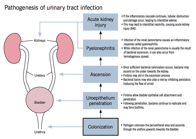 Pathogenesis of a urinary tract infection. 